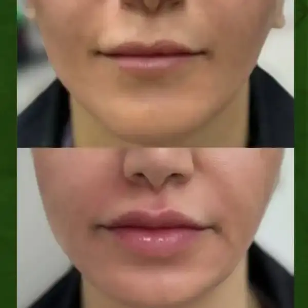 WhatsAppImage2025-11-12at10.17.23PM3-ezgif.com-resize