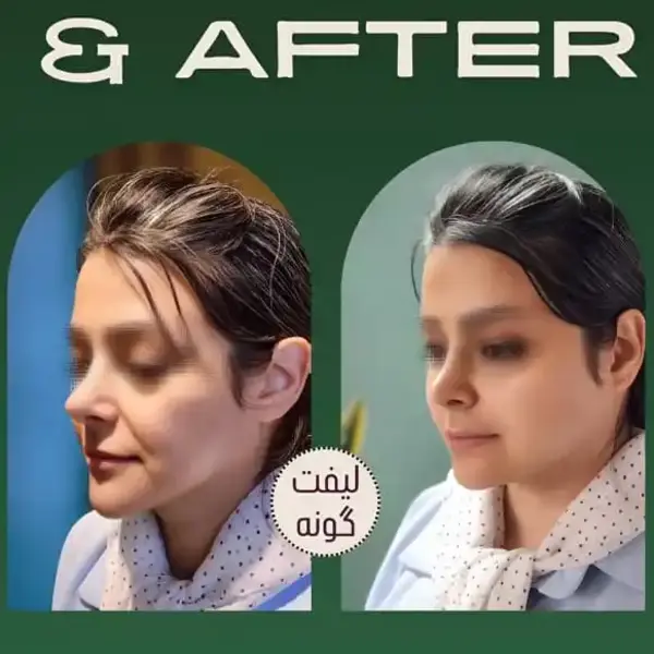 WhatsAppImage2025-11-12at10.17.24PM2-ezgif.com-webp-to-jpg-converter