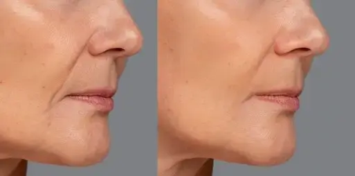 antiaging-beauty-treatment_23-2149123615-ezgif.com-crop